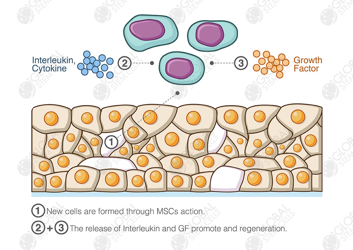 Global Stem Care Laboratories